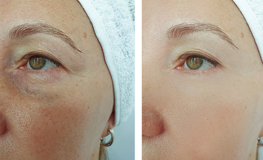 hyperpigmentation - tabihealth